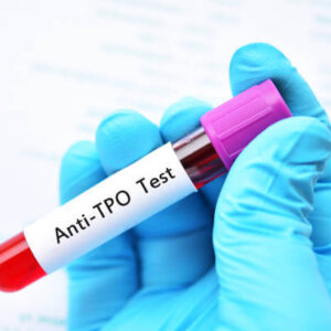 AMA Test (ANTI MICROSOMAL ANTIBODY)