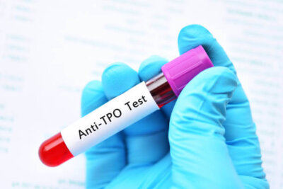 AMA Test (ANTI MICROSOMAL ANTIBODY)