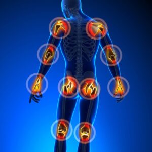 ARTHRITIS PROFILE ADVANCED (63 Test)