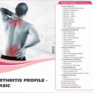 ARTHRITIS PROFILE BASIC (59 Test)