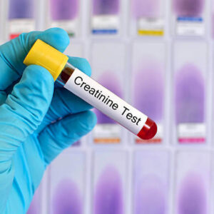 Serum Creatinine Test