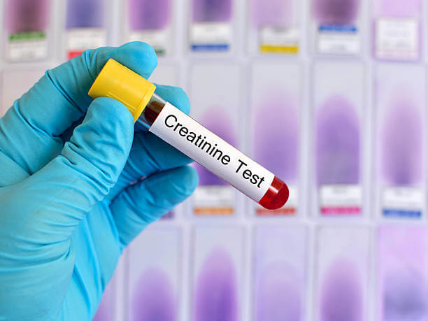 Serum Creatinine Test 200 Only FREE Home Collection