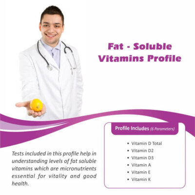 FAT SOLUBLE VITAMINS PROFILE