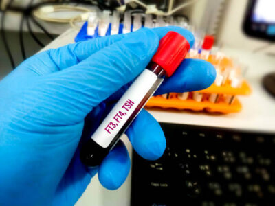 Thyroid Panel Test (FT3, FT4, UTSH)