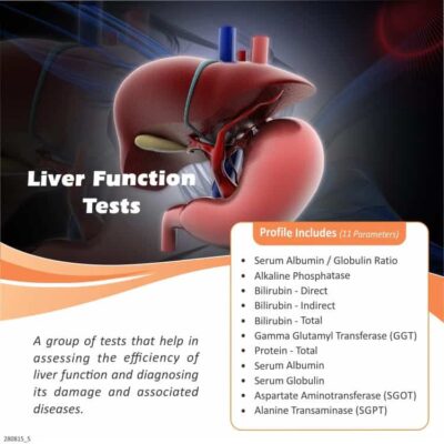 LFT (LIVER FUNCTION TEST)