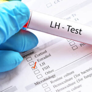 LH Test (LUTEINISING HORMONE)