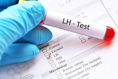 LH Test (LUTEINISING HORMONE)