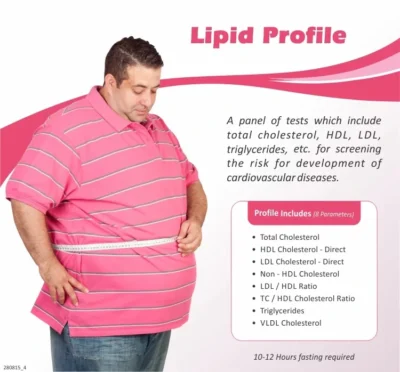 Lipid Profile Test