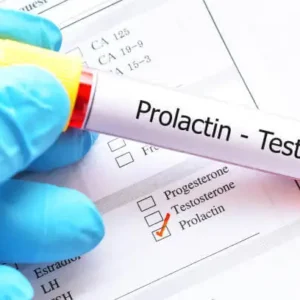 Prolactin Test