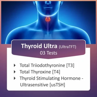 THYROID PROFILE TEST (T3, T4, USTSH)