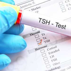 TSH Test (Ultrasensitive)