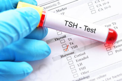 TSH Test