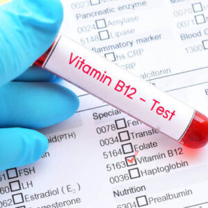 Vitamin B12 Blood Test