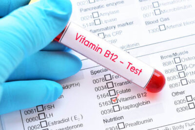 VITAMIN B-12 Blood Test