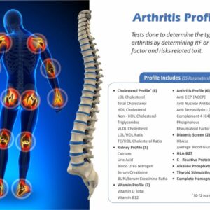 ARTHRITIS PROFILE TEST (55 Test)