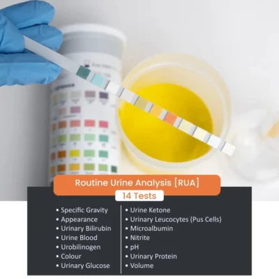 Urine Routine Analysis Test