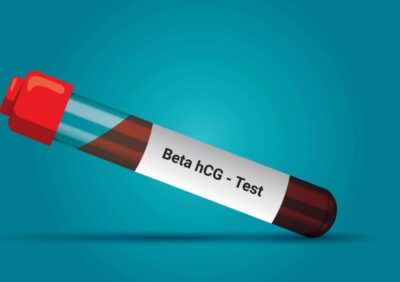 BETA HCG - Test