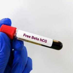 Free Beta HCG Blood Test 