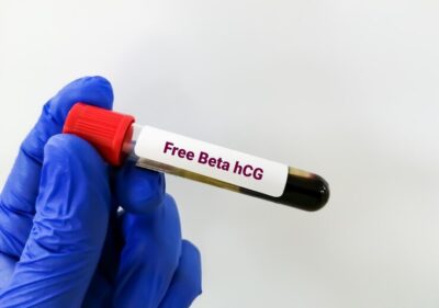 Free Beta HCG - Test