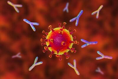 COVID ANTIBODY TOTAL- ELISA